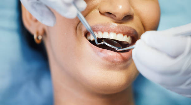 Best Tooth Infection Emergency Dentist  in Green Springs, OH