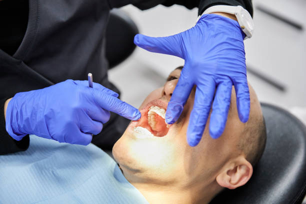 Best Broken Tooth Emergency  in Green Springs, OH