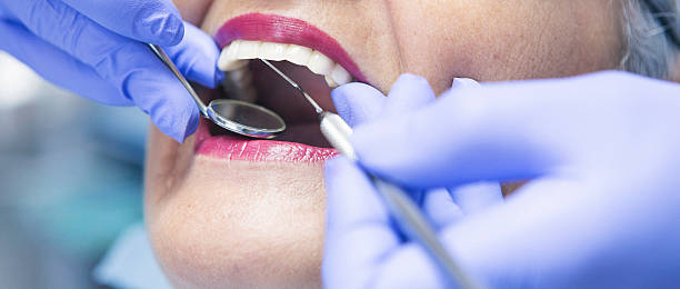 Best Cracked Tooth Emergency Dentist  in Green Springs, OH